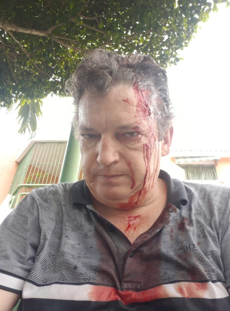 Delincuentes atracan y bañan en su sangre a un turista a plena luz del día en Boca chica