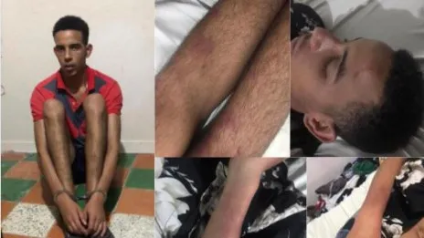 Joven es ingresado en área de psiquiatría tras supuesta golpiza en cuartel Ocoa