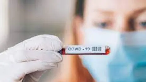 Salud Pública reporta 229 nuevos casos de coronavirus