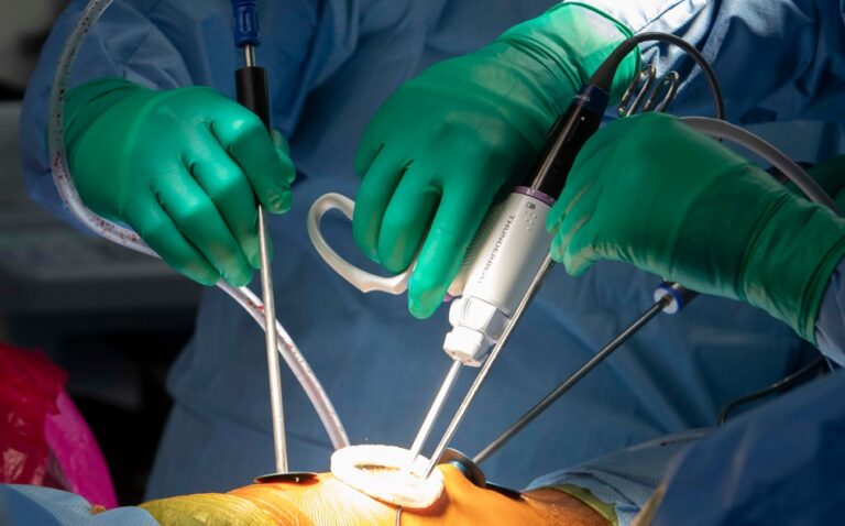 Realizan en el país primera cirugía de escoliosis sin abrir al paciente y con novedoso dispositivo
