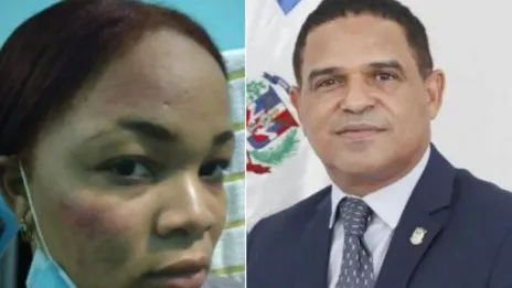 Suprema emitirá fallo juicio en fondo contra diputado Sadoky Duarte este miércoles