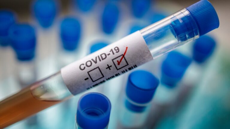 Salud Pública reporta ocho nuevos casos de covid-19, que sigue a la baja