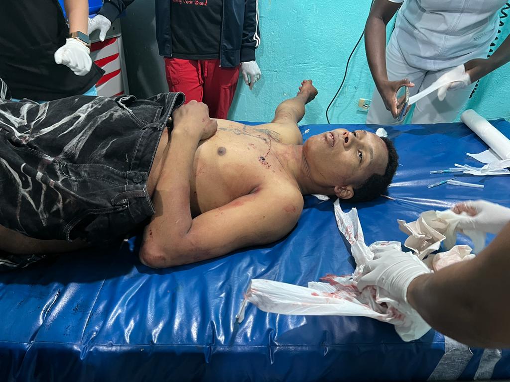 Cae abatido presunto delincuente “Bryan Bomba” tras alegadamente enfrentar una patrulla