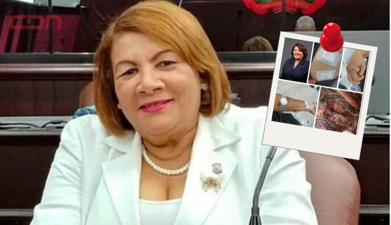 Exdiputada peledeísta Cleo Sánchez es agredida con arma blanca por un delincuente