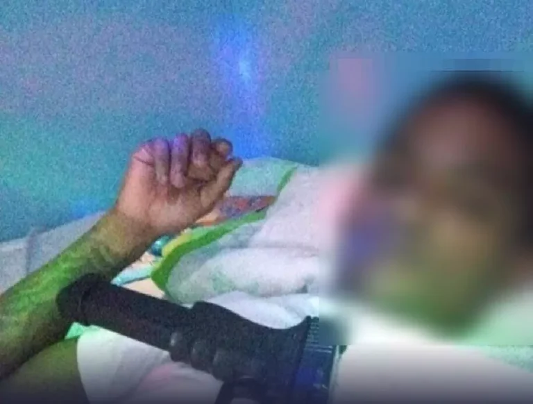 Cae abatido “Potrico” tras enfrentar patrulla policial en San Cristóbal