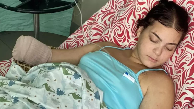 Joven mocana que soñaba con ser enfermera, fue al hospital por náuseas y terminó sin su mano derecha