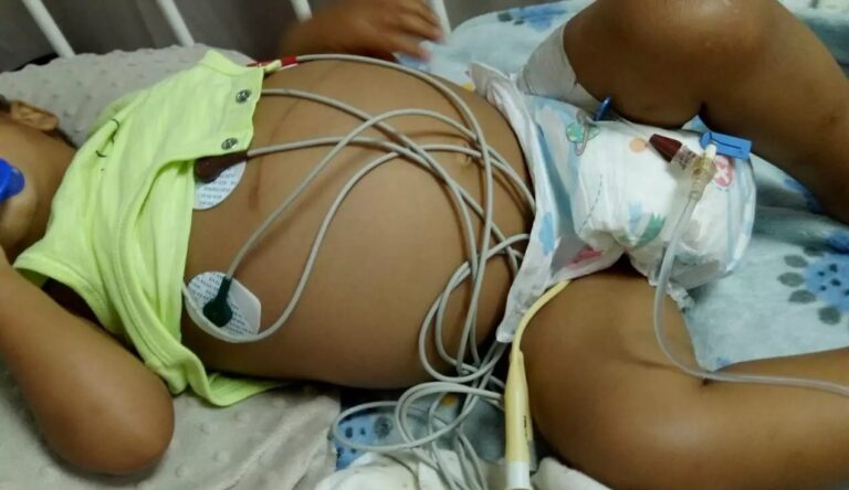 Madre desesperada ayuda para costear viaje por trasplante de hígado a su hijo en España