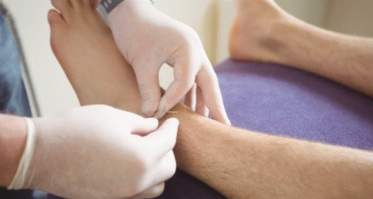 Especialistas alertan sobre incremento de patologías vasculares en RD