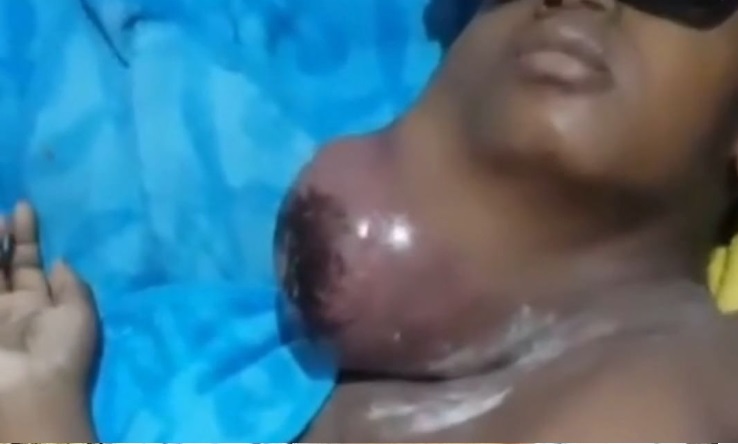 Madre solicita ayuda para niño con tumor; asegura ningún hospital quiere dar asistencia