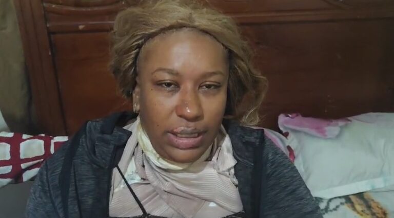 Mujer denuncia hombre celoso le rocía gasolina y le prende fuego