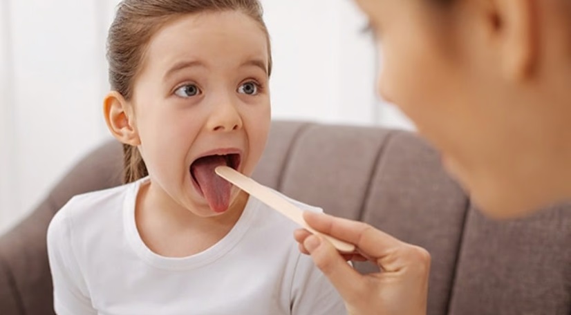 Revelan del 15% y 30% de los casos de dolor de garganta en niños están vinculados a infecciones