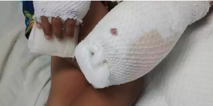 Fiscalía de La Vega solicita prisión preventiva contra madre quemó manos a su hijito y le introdujo lapicero por un oído