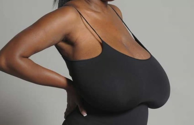 Cirugía de reducción de mama, más que estético, es una necesidad de salud