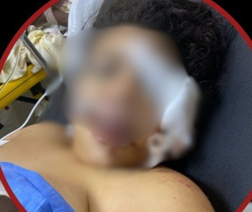 Muere colombiana herida de bala en la cabeza por su pareja en Haina