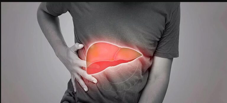 Cómo saber si tengo hígado graso y qué cambios en la alimentación recomiendan los expertos