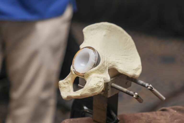 Farmaconal realizó la Jornada de Artroplastia, un encuentro científico de alto nivel sobre el reemplazo articular de cadera