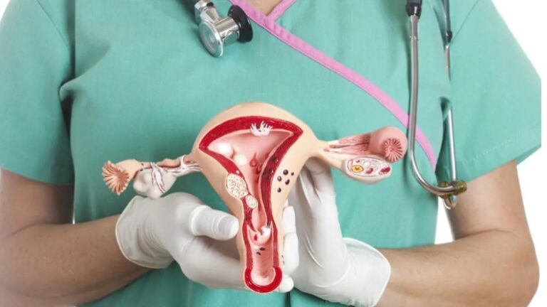 OMS lanza el Día contra el cáncer de cuello uterino, que causa 350,000 muertes anuales