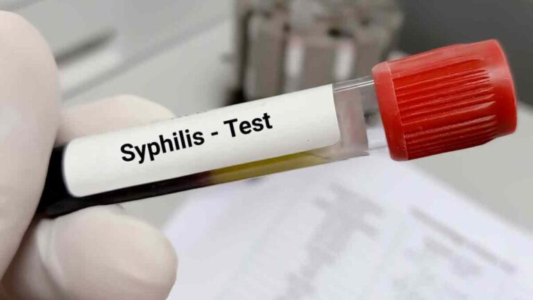Casos de sífilis en adultos aumentaron en las Américas