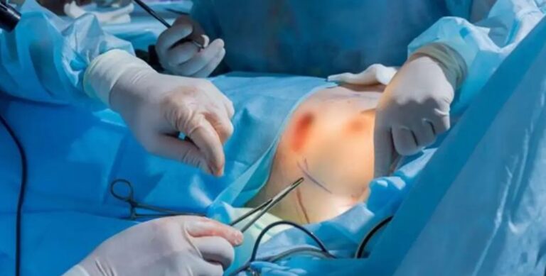 Cirujano impulsa la mamoplastia de reducción como cirugía de salud en la República Dominicana