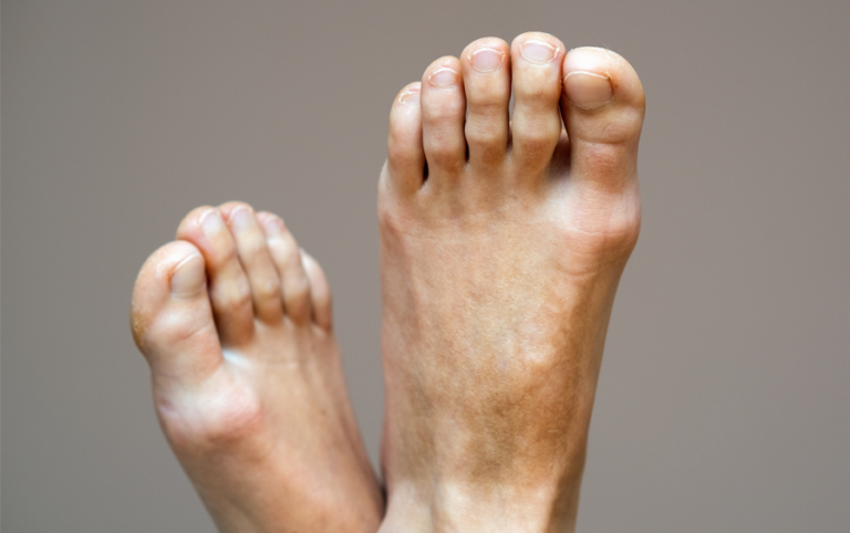 ¡Adiós, sicote! Los verdaderos consejos para eliminar el hedor en los pies