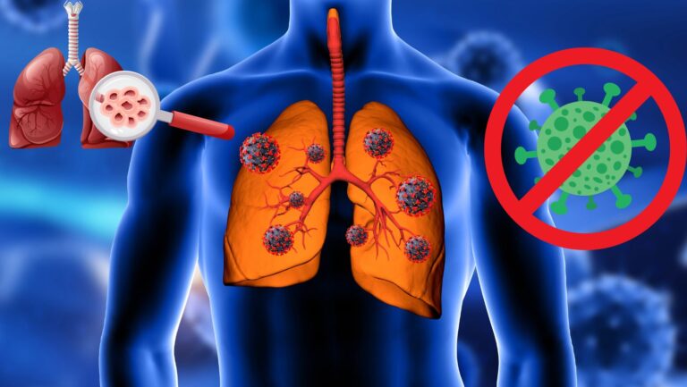 Alertan sobre alto costo de la fibrosis quística en RD y llaman a fortalecer apoyo estatal