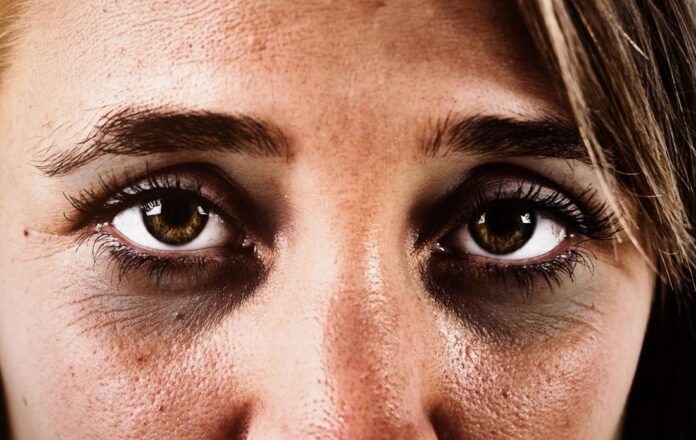 OJERAS