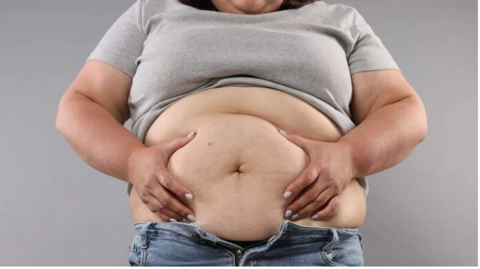 OBESA